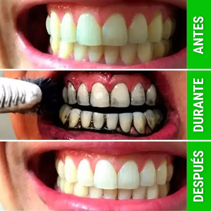 Pasta Blanqueadora de Dientes "Miracle Teeth Whitener" - ¡Recupera la blancura natural de tu sonrisa de forma segura y natural! PAGA UNA Y LLEVA 2